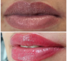 Lippenpigmentierung